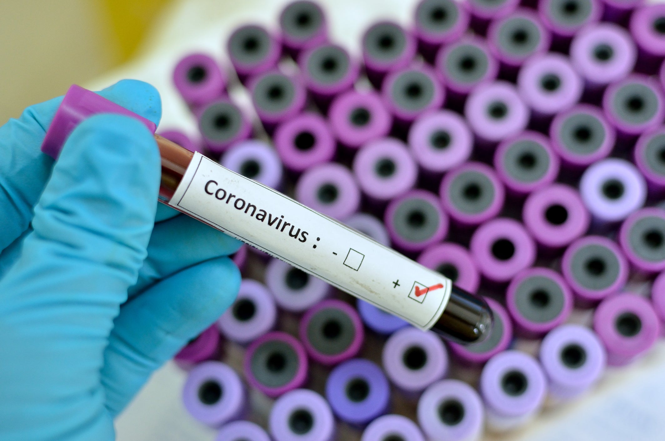 Criza coronavirusului din China dă bătăi de cap companiilor din Lugoj
