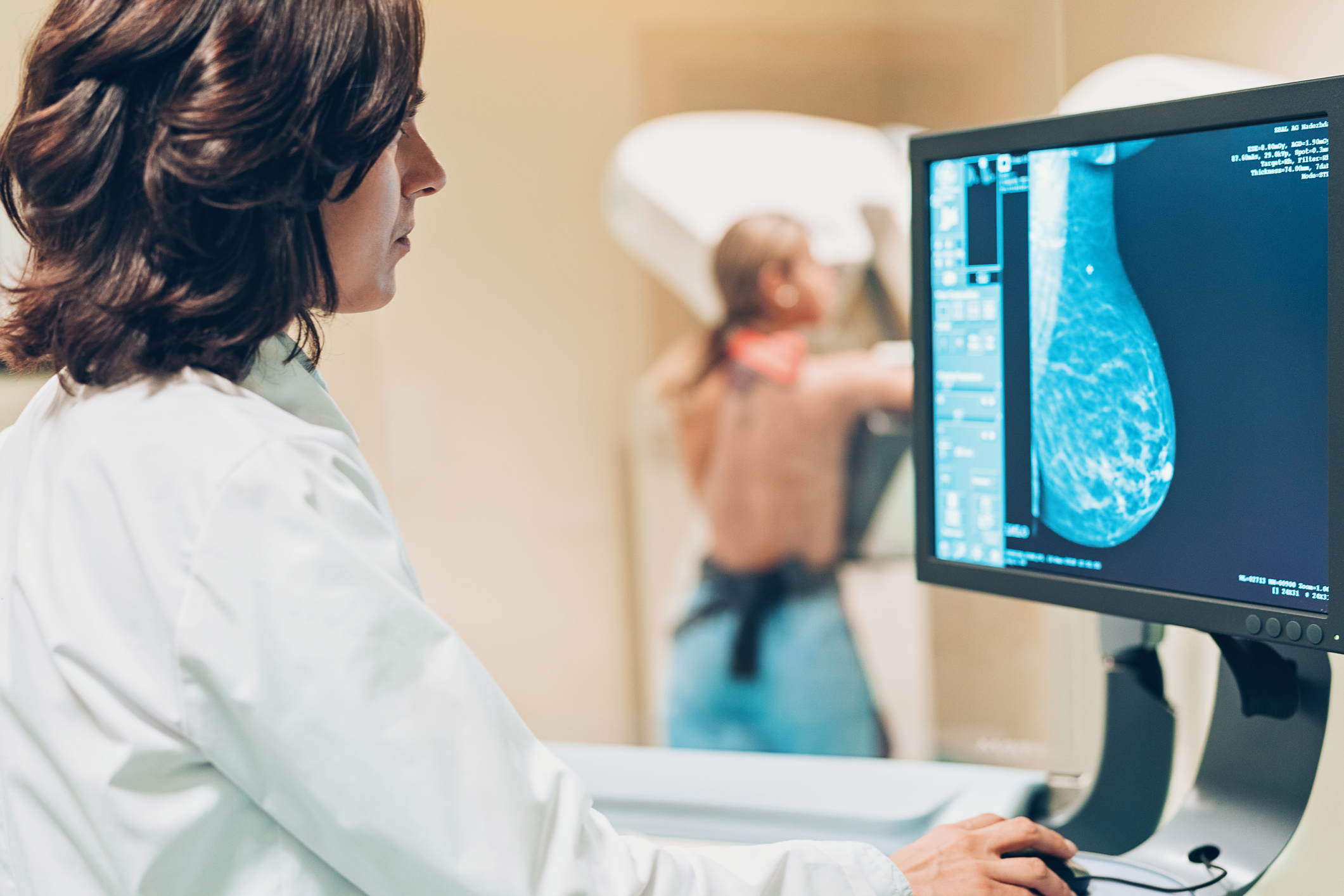 Luna martie aduce mamografii gratuite pentru femeile din Vestul ţării